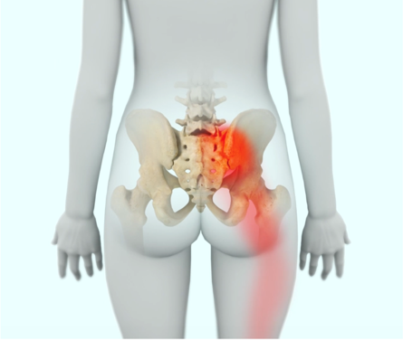 Sacroiliac (SI) joint