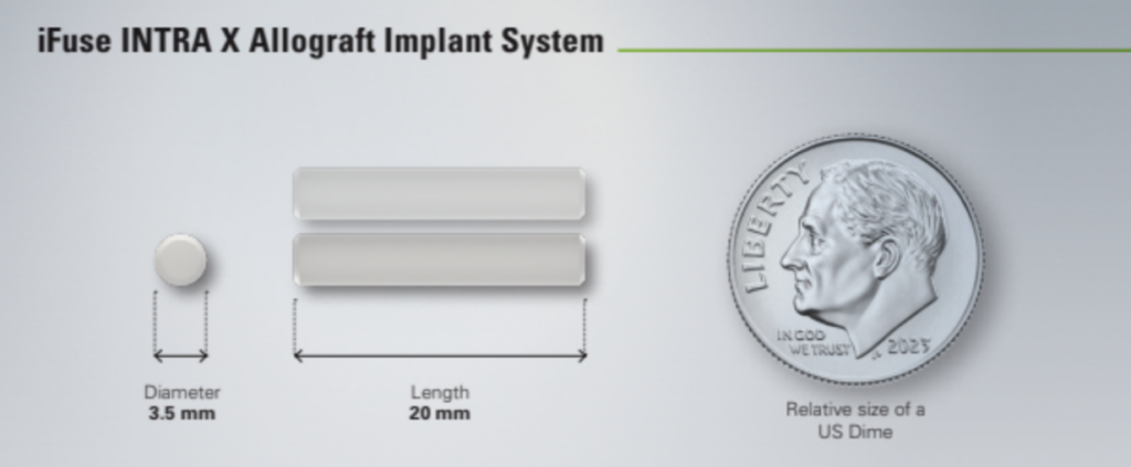 iFuse INTRA X® Allograft